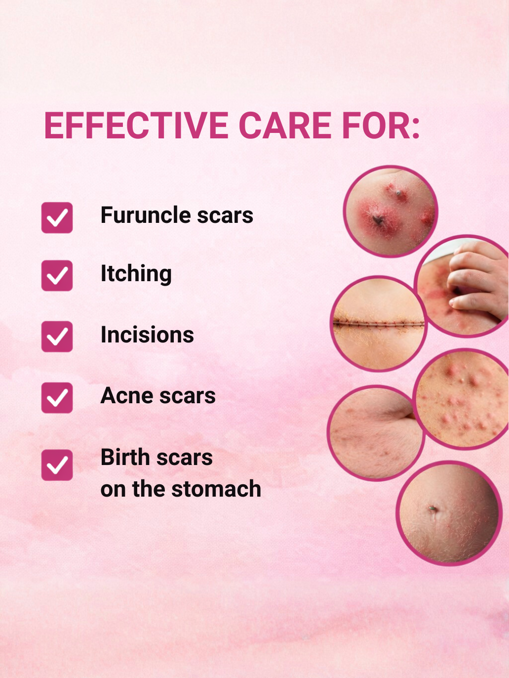 Effective care for furuncle scars, itching, incisions, acne scars, and birth scars