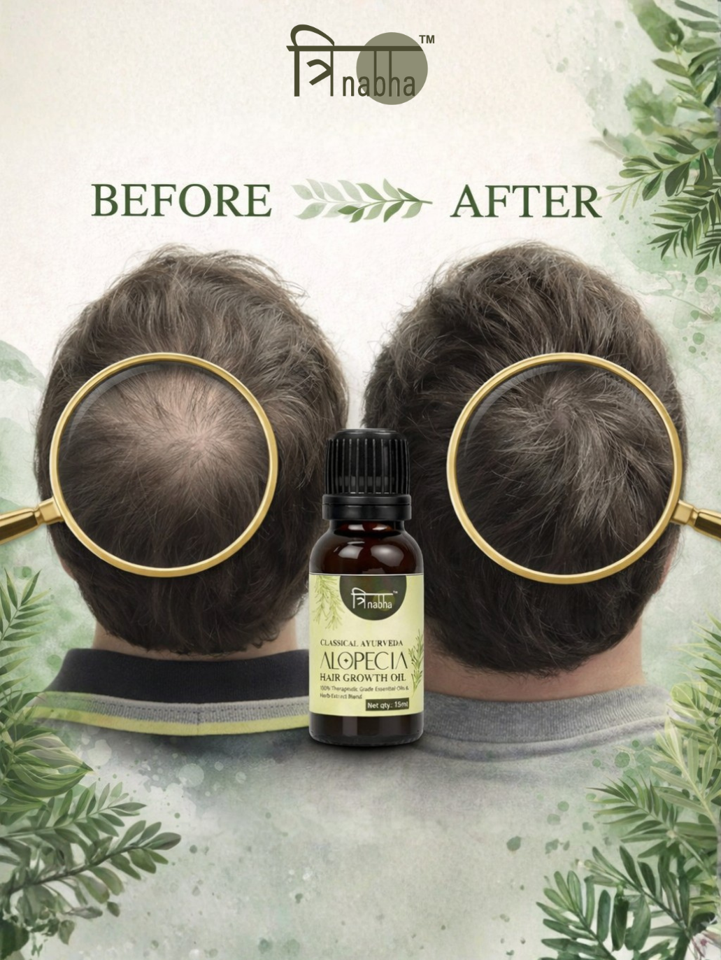 Before and after comparison of male pattern baldness showing hair regrowth using Trinabha oil.