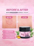 Before and after comparison showing how the herbal cream stops itching and clears infection.